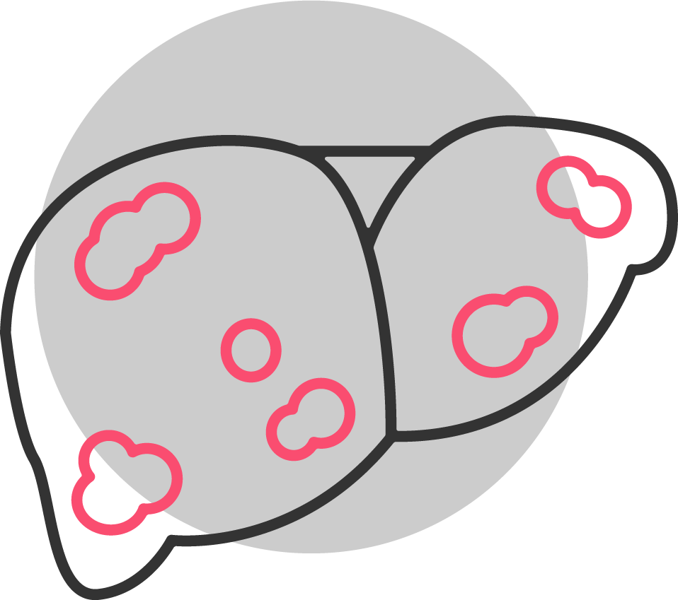 Microscopic view of Streptococcus pneumoniae bacteria